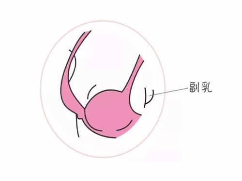 副乳结构图图片