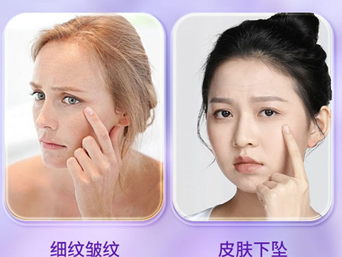 熬夜垮臉、內(nèi)分泌紊亂、抗衰焦慮？這瓶“維萃美麥角硫因”正在悄悄改變中國女性