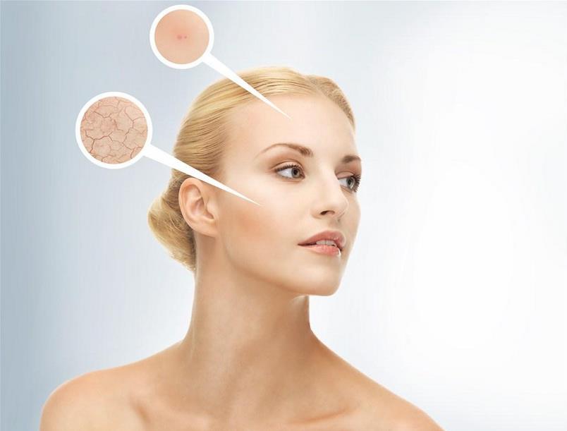 玫琳凯帮你解决皮肤干燥问题  肤干燥的原因.jpg