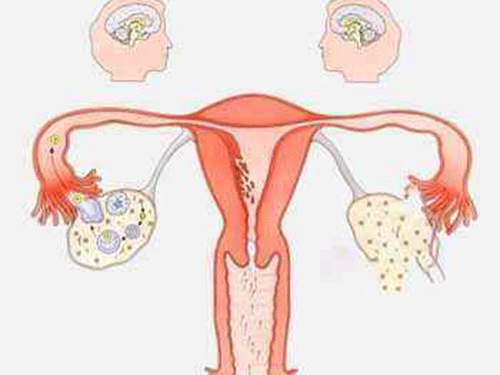 子宫卵巢