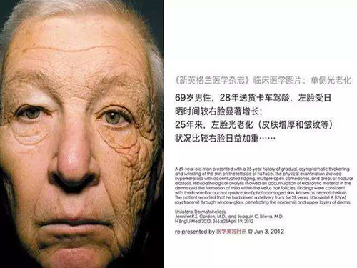 当初老来临，如何有效抗衰？补充温莎之谜胶原蛋白很重要！