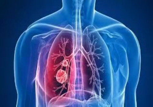 怎么养肺健康
