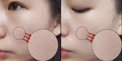 冬日救命级补水——Zedd复活草面膜,我囤了不下一百次