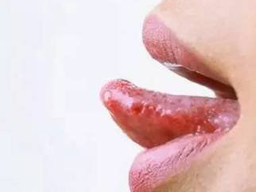 舌头尖起泡是什么原因引起的