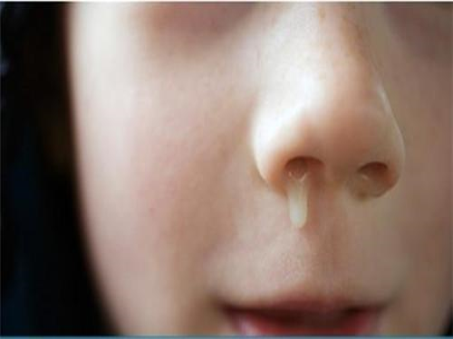 小孩流鼻涕的表情图图片