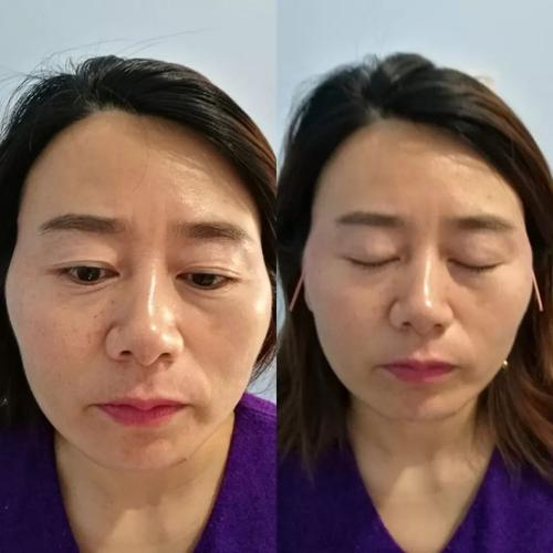 科琳卡青春定格液,打造“0”毛孔细腻肌