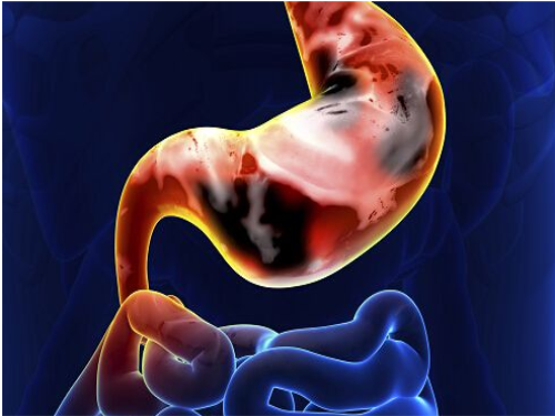 胃肠炎有什么症状 怎么判断自己是不是肠胃炎