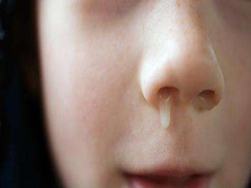 鼻子流清水是什么原因
