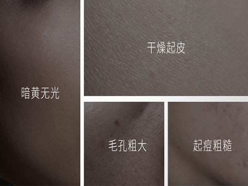 跨年夜元旦Zedd面膜种草，让你的肌肤水嫩嫩~