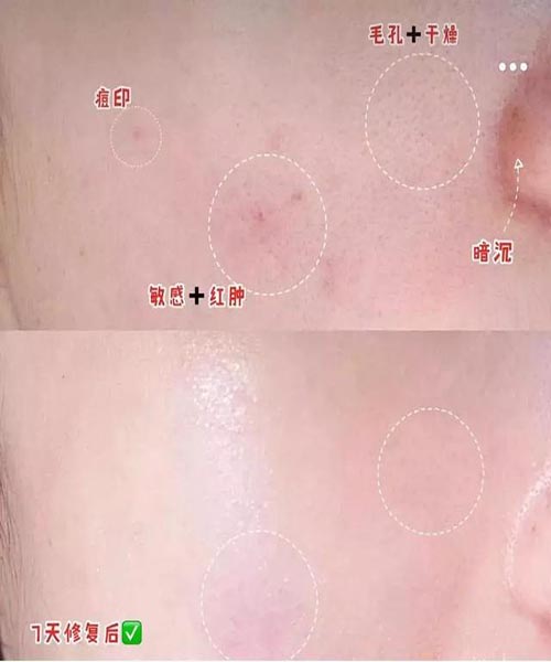 片状面膜用烦了，试试膏状的Zedd面膜???