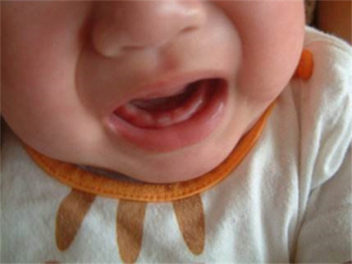 宝宝长牙顺序不对的原因