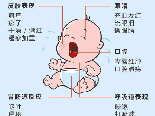 宝宝过敏怎么办 宝宝过敏应该如何处理
