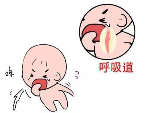 宝宝肺炎的早期症状