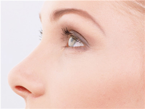 缩小鼻翼的自然方???