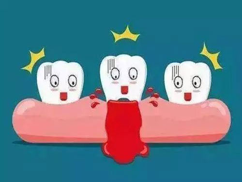 刷牙出血是怎么回事 牙龈炎 牙周炎