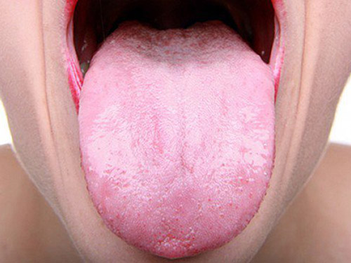 口中发苦是什么原因造成的