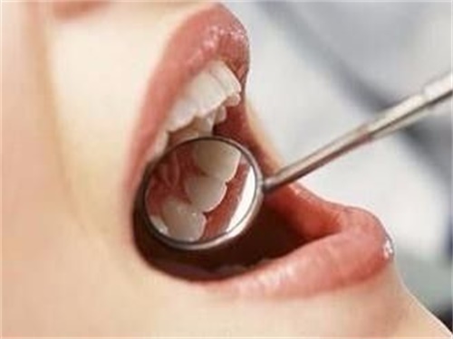 如何自己清理牙结???