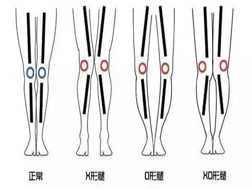 腿不直?€么矫???