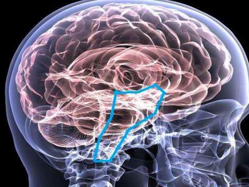 脑干出血的原因