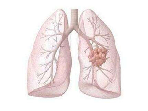 肺痨的症???