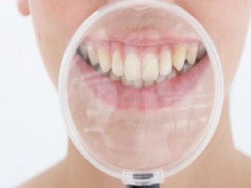 磨牙是什么原因引起的