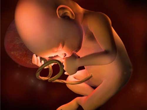 胚胎发育不良性神经上皮瘤