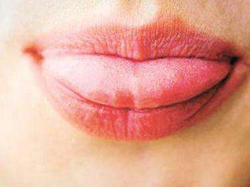 舌头臭是什么原因