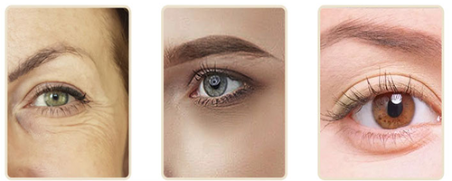 仙格丽精华眼霜，无惧眼纹，笑出强大