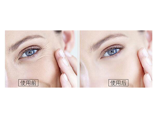 为什么要用面霜？温莎之谜胞抗衰面霜值得一试