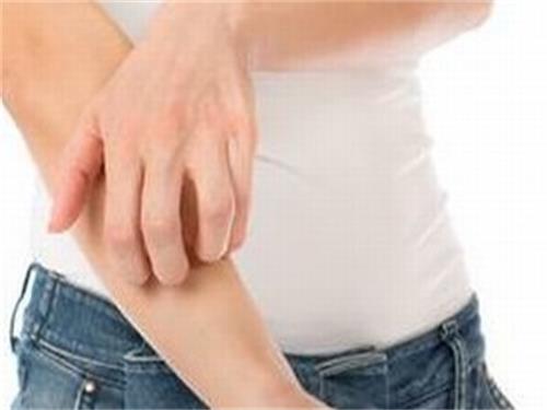 潮湿疙瘩止痒小妙???