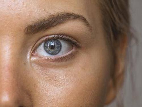 过敏性角膜炎是怎么引起的 过敏性角膜炎用什么眼药水