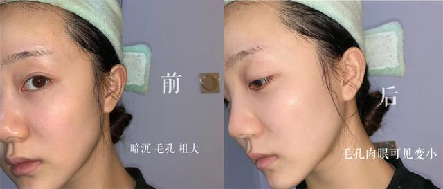 补水选“Zedd复活草面膜”，让肌肤时刻保持水嫩