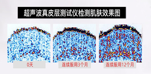 为什么要选仙格丽鱼胶原蛋白肽？答案全解密