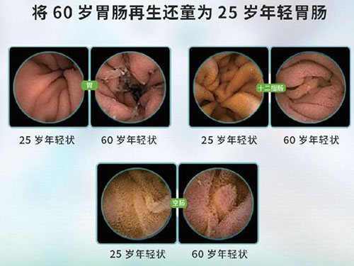 胃肠功能紊乱不适怎么办？维萃美胃肠胶囊助您修复肠胃