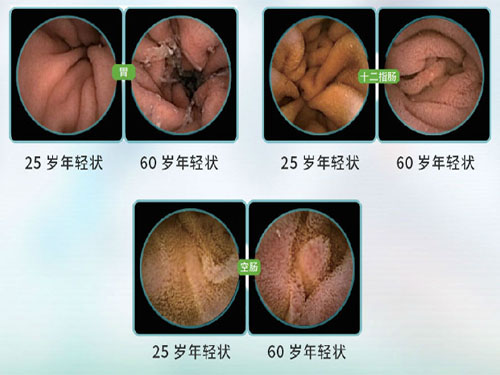 关爱自己，健康呵护就选维萃美胃肠胶囊
