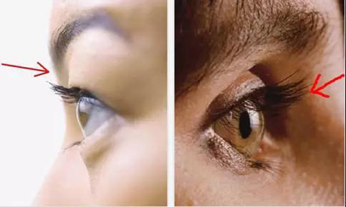 眼窝凹陷太显老，快用温莎之谜胶原蛋白肽补一补